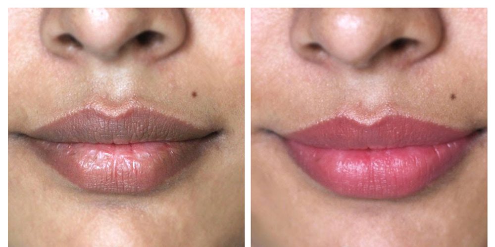 غمقان لون الشفاه