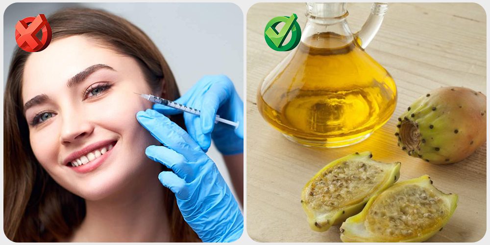 زي التين الشوكي