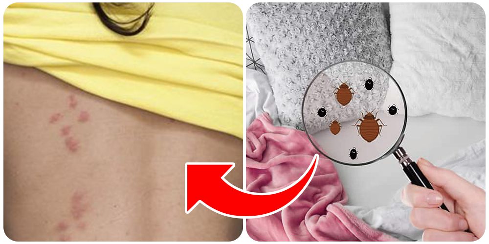 حشرات الفراش