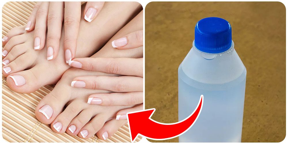 فرنش الأظافر