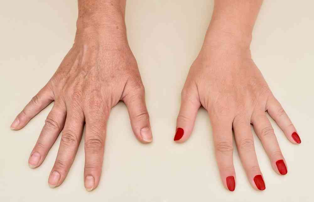 استعادة شباب اليدين