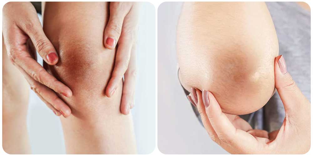 تفتيح الركبة والكوع