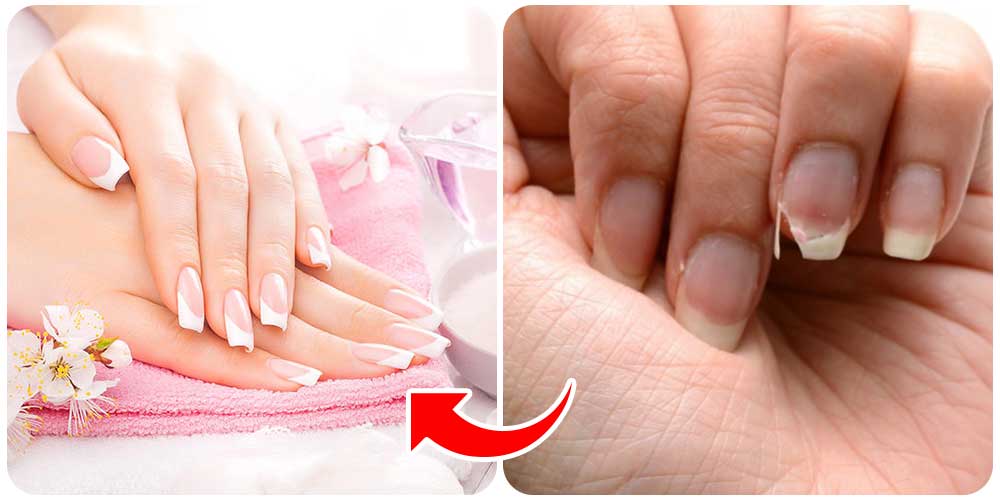 الأعتناء بالأضافر