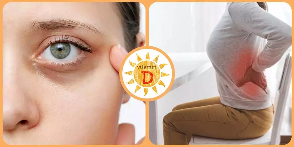 نقص فيتامين د